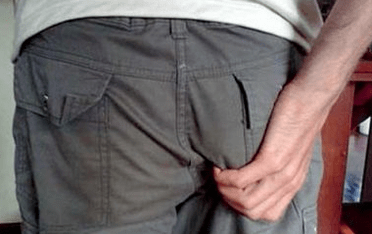 Itching in the anus as a symptom of the presence of parasites.