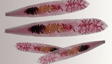 Opisthorchis parasites in the human body.