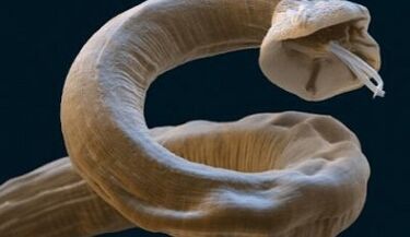 The Ascaris parasite in the human body.