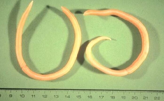 pinworms of the human body