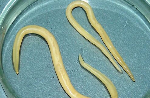 intestinal worms from a child's body