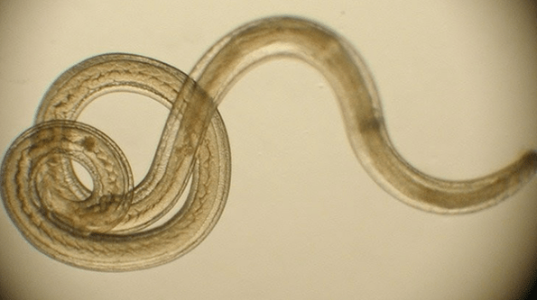worm parasite of the human body