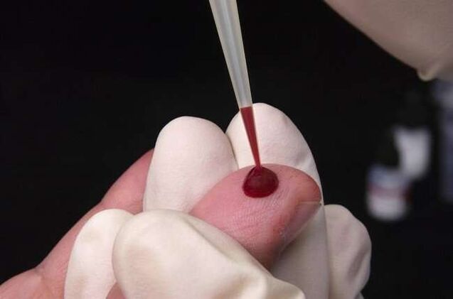 blood collection for parasite testing