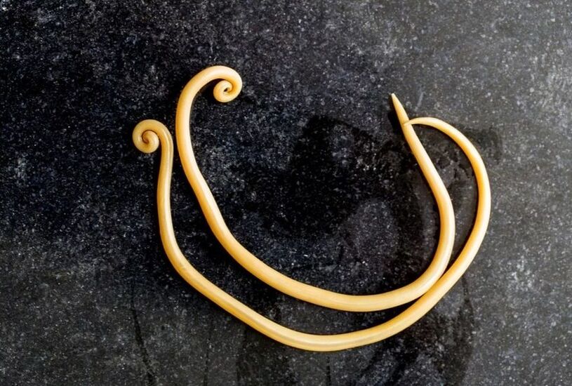 Roundworms are the most common parasite in the human body. 