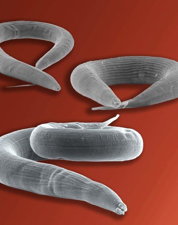 milyen paraziták okozzák a bőr viszketését paraziták dokumentálják