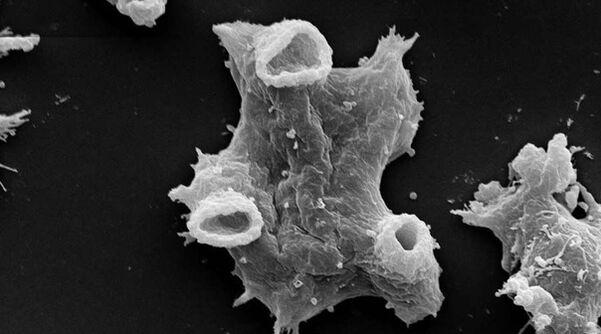 Negleria fowlera is a dangerous protozoan parasite for human life. 