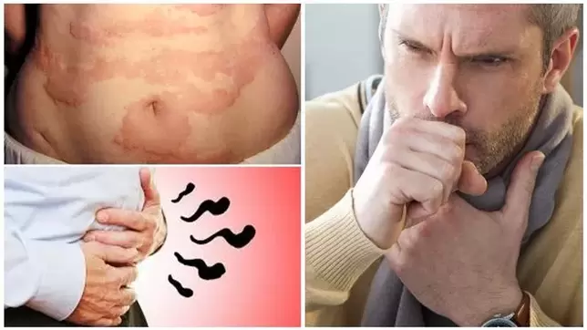 Allergies, cough and swelling are signs of damage to the body by worms. 