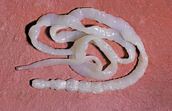 parasitic worm from the body of a child