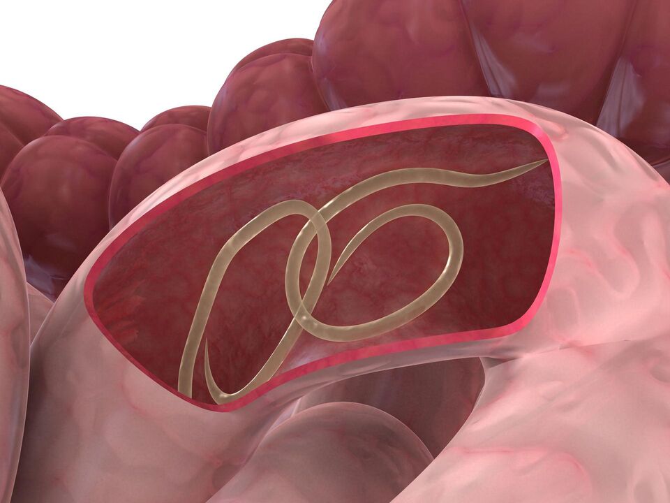 worm in human intestine