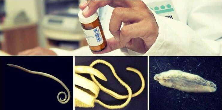 Types of worms and medicinal method to get rid of them. 
